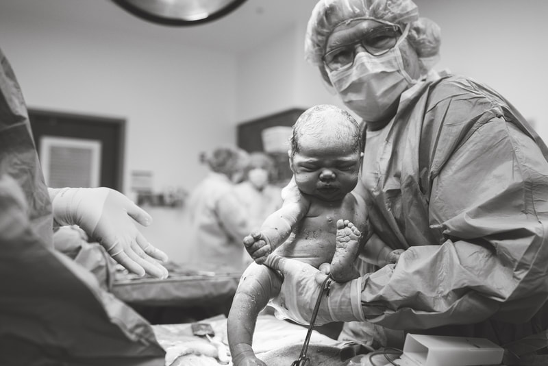 Newborn right after c-section at Forbes Hospital